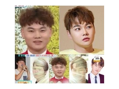 박서진 성형 사실 털어놓는다