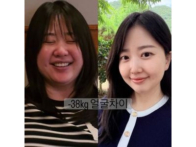 박수홍 아내 김다예 90kg 시절 사진에 충격적인 반응